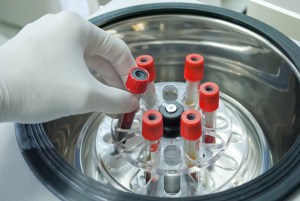 Platelet Rich Fibrin